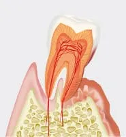 歯が抜けてしまう