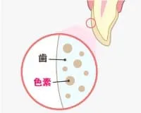 歯の色が黄色い状態