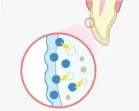 ホワイトニング剤を塗布