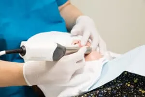 口腔内スキャナー