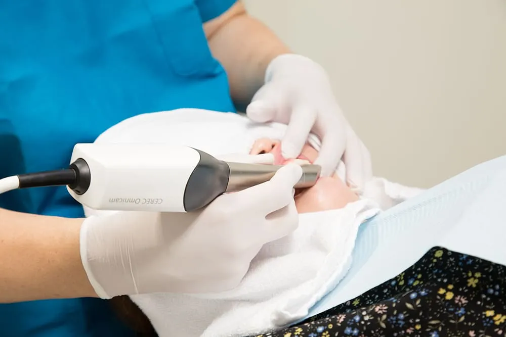 口腔内スキャナー