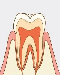 白濁が見られる
