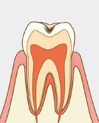 自覚症状がない