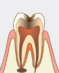 ズキズキと痛む