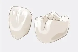 セラミッククラウン