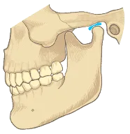 噛み合わせの治療について