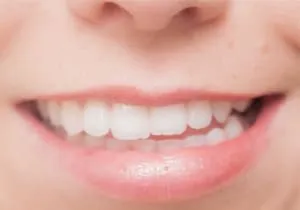 噛み合わせが悪くなる原因