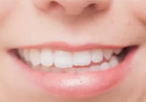 噛み合わせが悪くなる原因