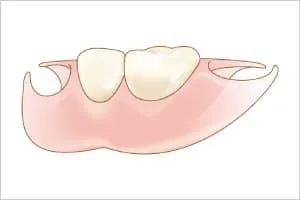 エステティックデンチャー