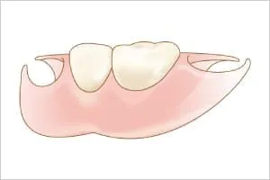 エステティックデンチャー